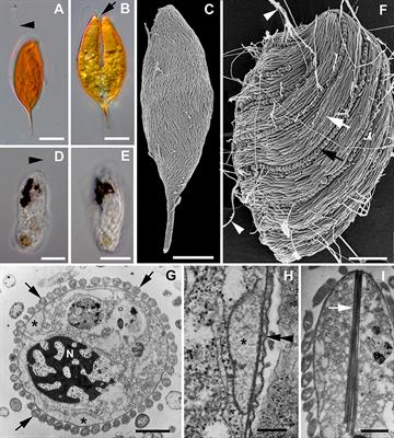Diversity and Evolutionary History of the Symbiontida (Euglenozoa)